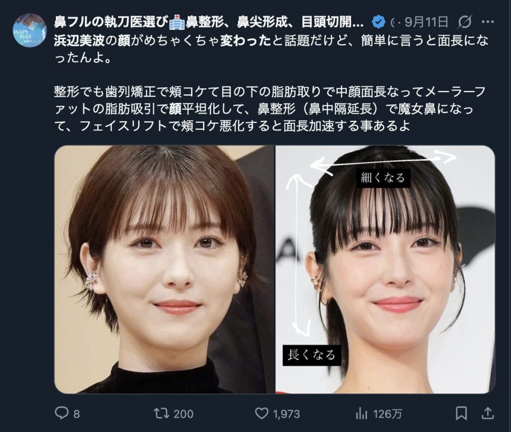 浜辺美波の顔変わった真相は？子役時代と現在の比較で整形疑惑を検証