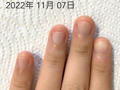【画像あり】 爪 が 早く 伸びる 方法 話題のバズ動画・画像 #715