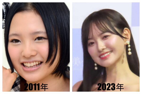 兒玉遥の整形前と現在の顔立ちを徹底比較！本人が明かした激変の真相