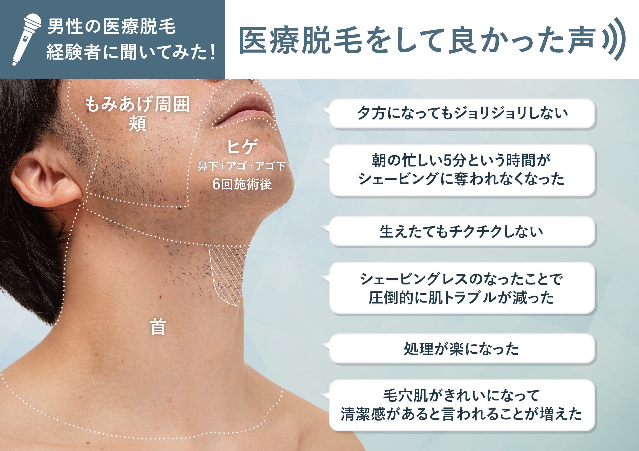 湘南美容外科のヒゲ脱毛は効果なし？後悔の真相と2026年最新料金