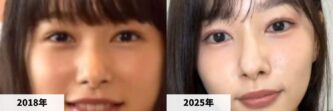 【Wiki風】 桜井 の のか 整形 最新ファイル＆画像まとめ #810