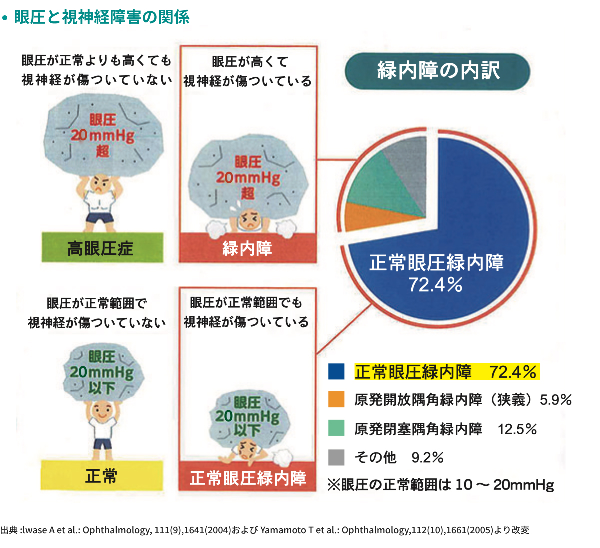 緑内障の初期症状と見え方の真実！40代からの早期発見セルフチェック法