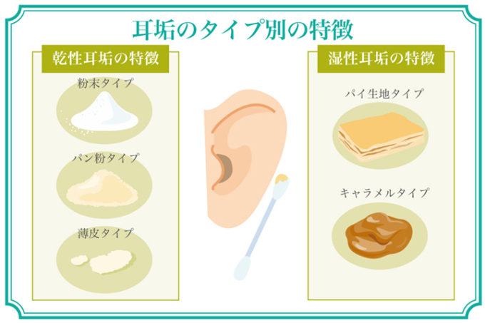 耳が湿っている原因は？体質・遺伝と病気のサイン＆ワキガの真相