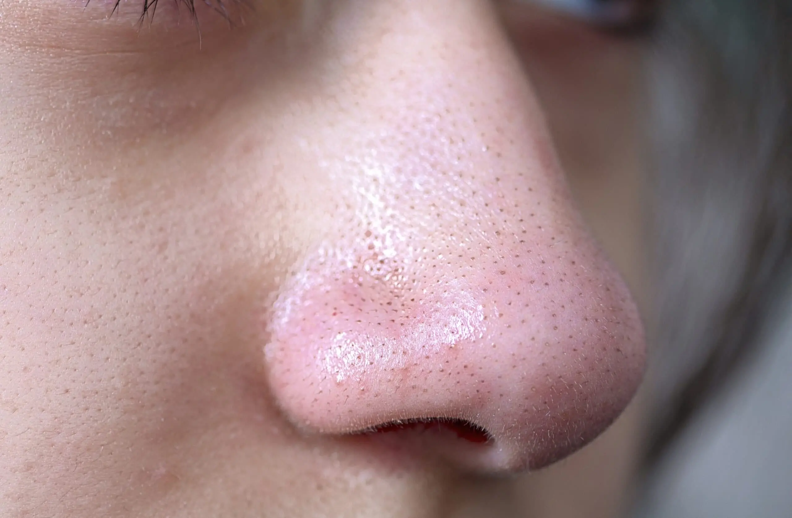 洗顔は逆効果？鼻の毛穴黒ずみが消えない真相とプロ直伝の正しい治し方