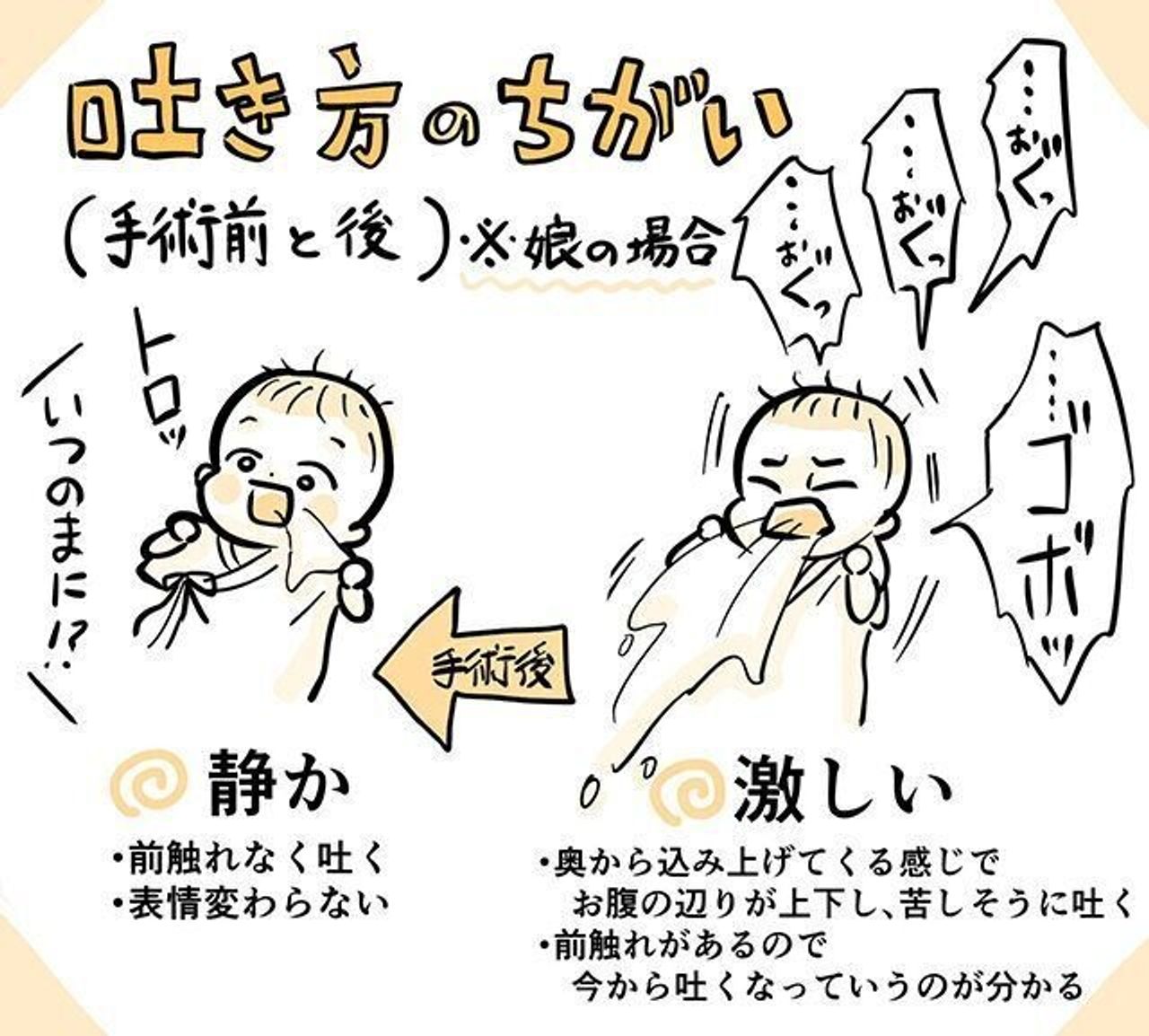 赤ちゃんがミルクを吐くのはなぜ？病院へ行くべき危険な嘔吐サインを徹底解説