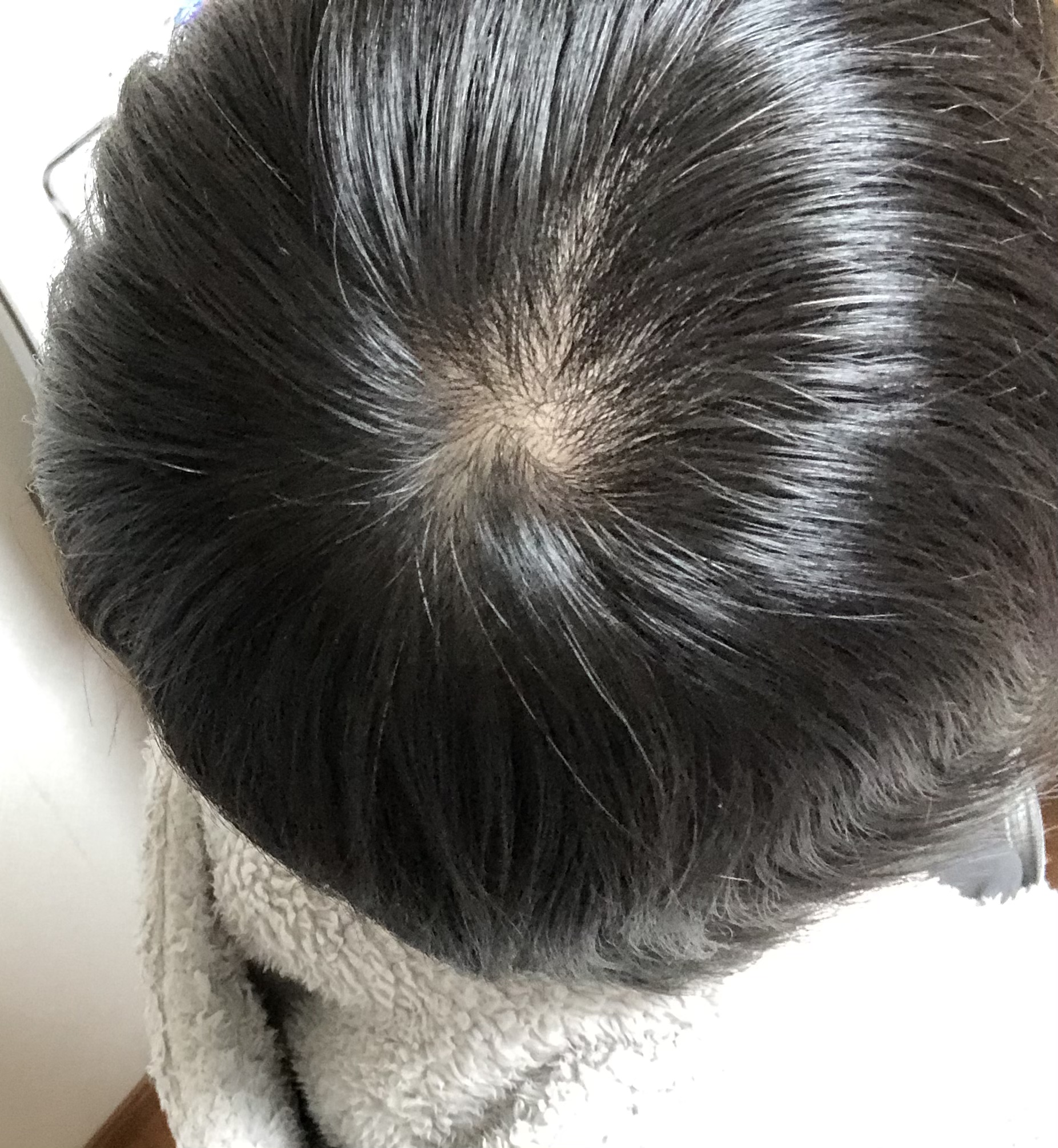 【2026年最新解説】つむじが2つある人の知られざる真相：ハゲやすさの噂から毛流れを活かすプロの最新スタイリング術まで