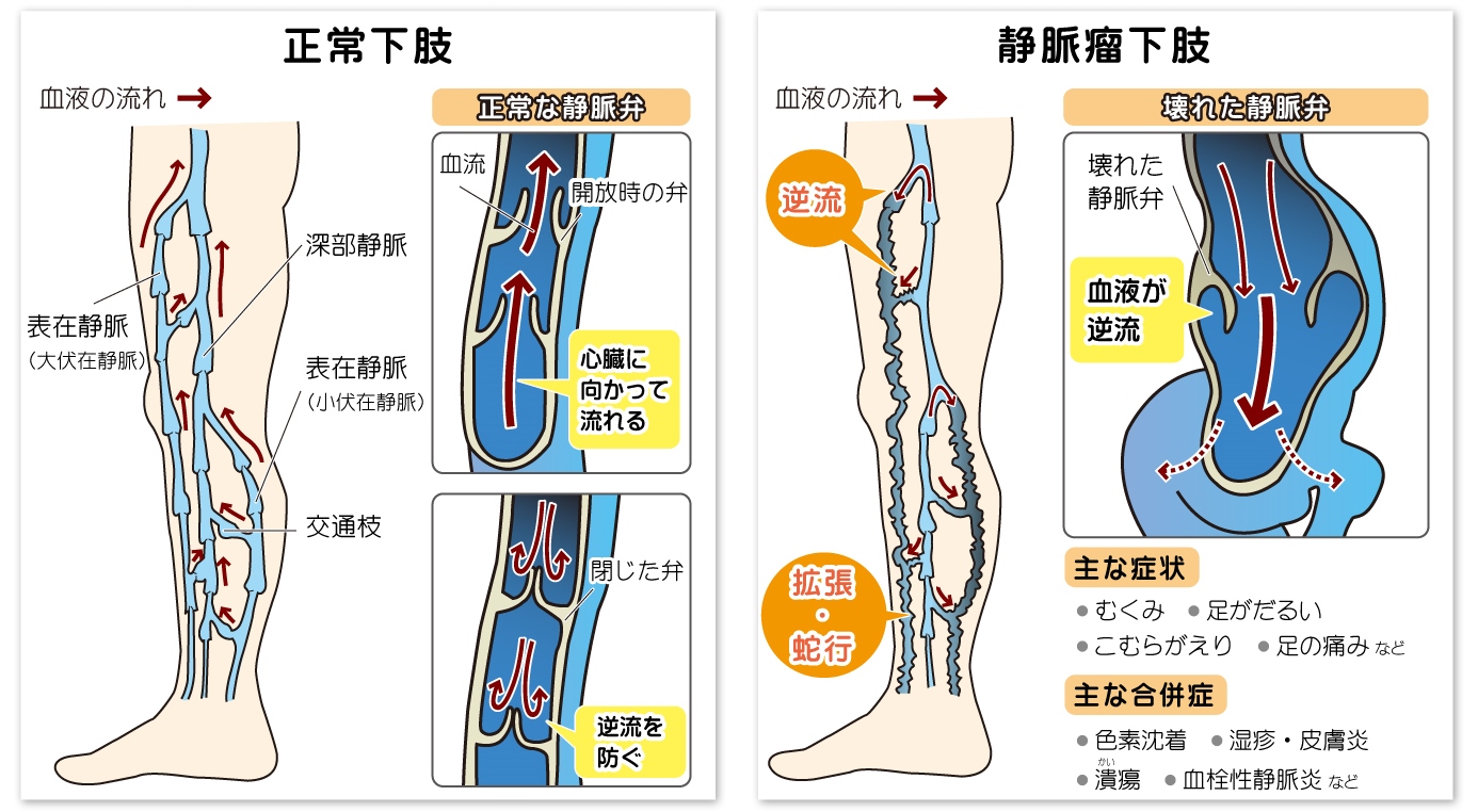 夜に足がムズムズする原因とは？眠れない理由と効果的な治し方