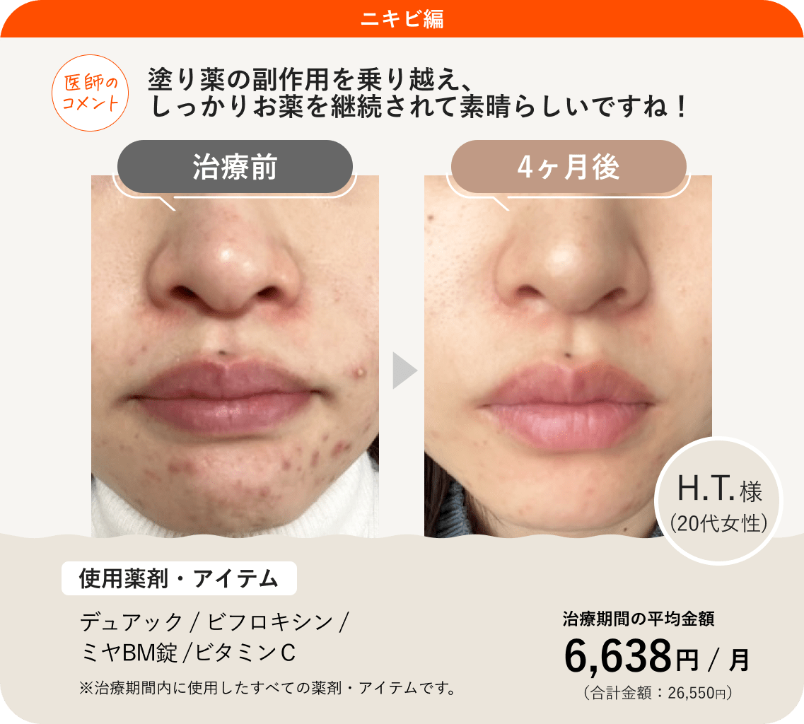 ミヤBmの効果と強ミヤリサンの違いは？酪酸菌の真実を徹底検証