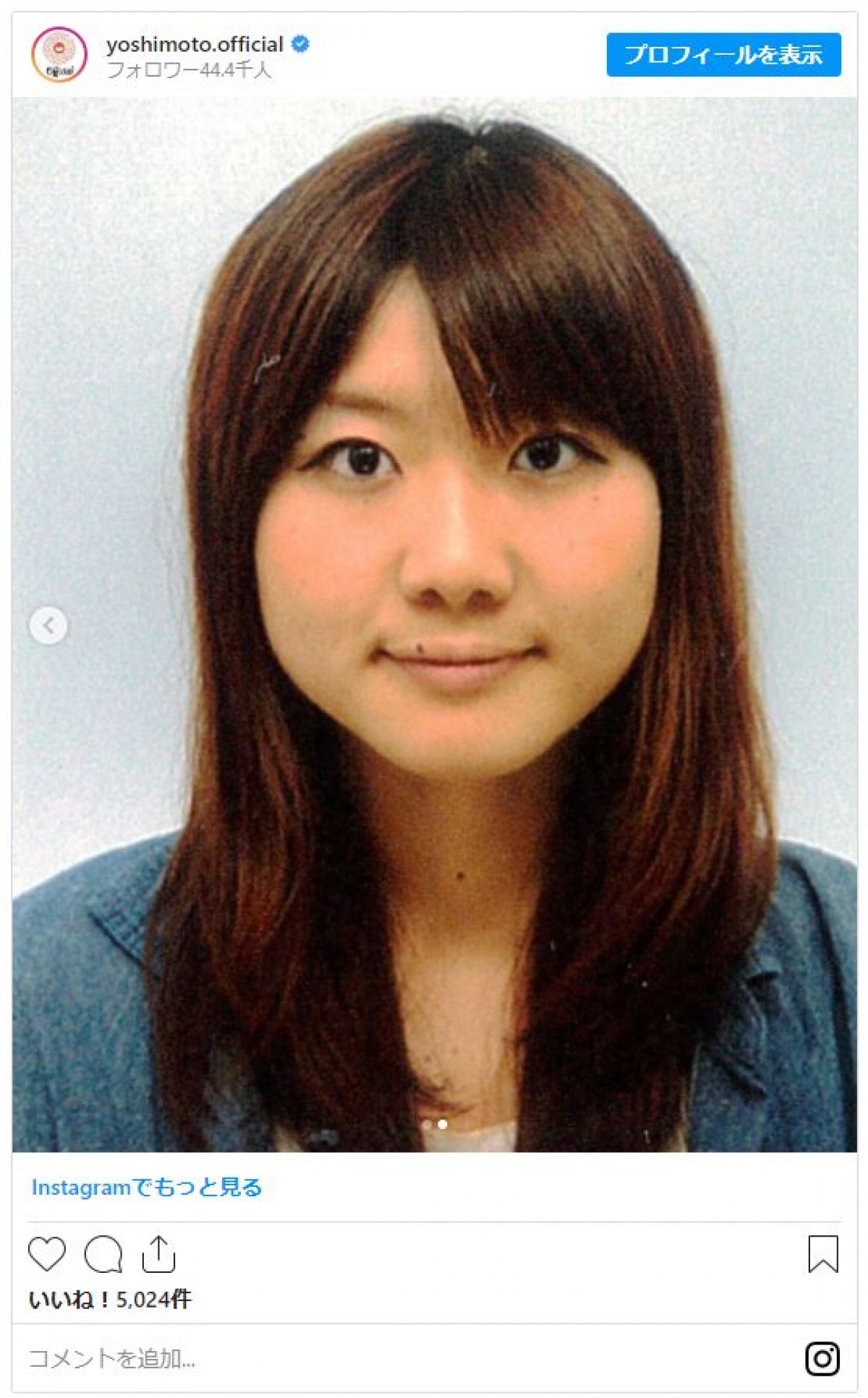 ガンバレルーヤよしこの昔の写真が美人すぎ！激変の真相と現在