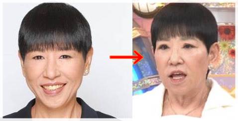 【衝撃】 和田 アキ子 顔 変わっ た 気になる噂と真相 #678