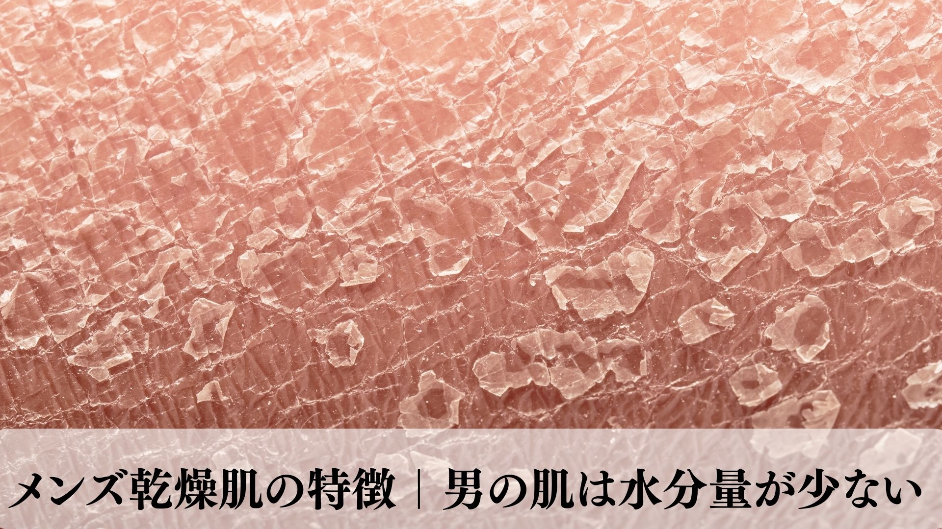 乾燥肌に化粧水が浸透しない真相と2026年最新の選び方・厳選比較