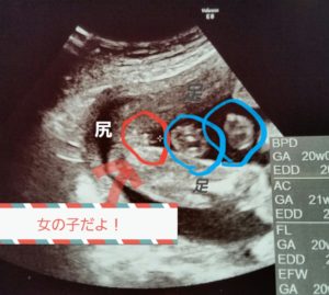 【速報】 妊娠 性別 女の子 特徴 話題のSns投稿まとめ 2026 #750