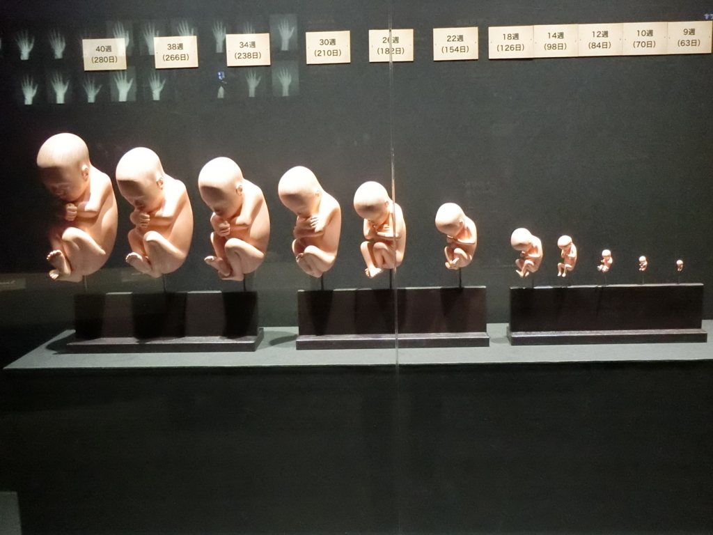 人体の不思議展の中止理由と闇｜遺体の身元と標本の行方を徹底追跡