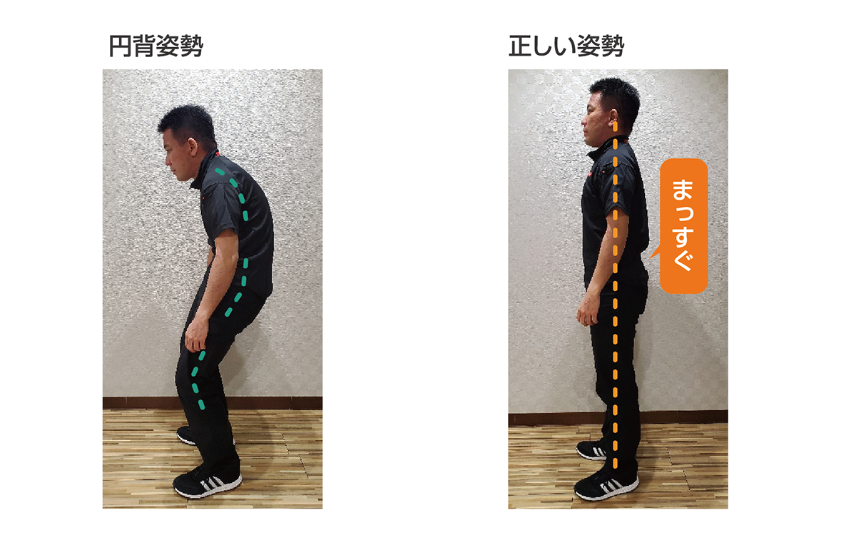 背中が曲がってる原因は病気か猫背か？放置リスクと最新改善法