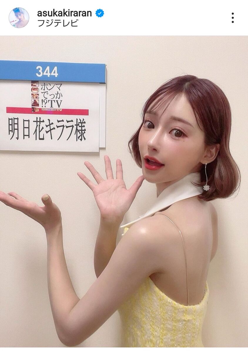 明日花キララの整形総額と公言箇所は？昔の写真と比較検証