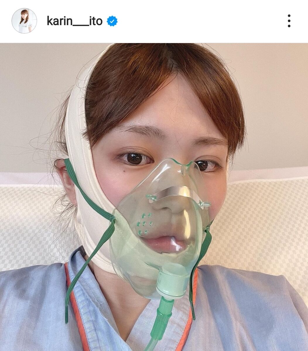 顎変形症手術を公表した芸能人の真相｜劇的変化と過酷なダウンタイム