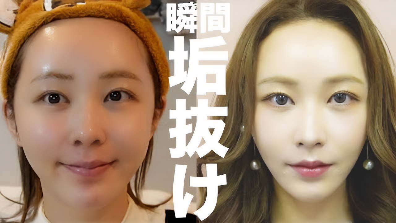 てんちむの整形箇所と総額は？昔と現在の顔変化＆真相を徹底解剖