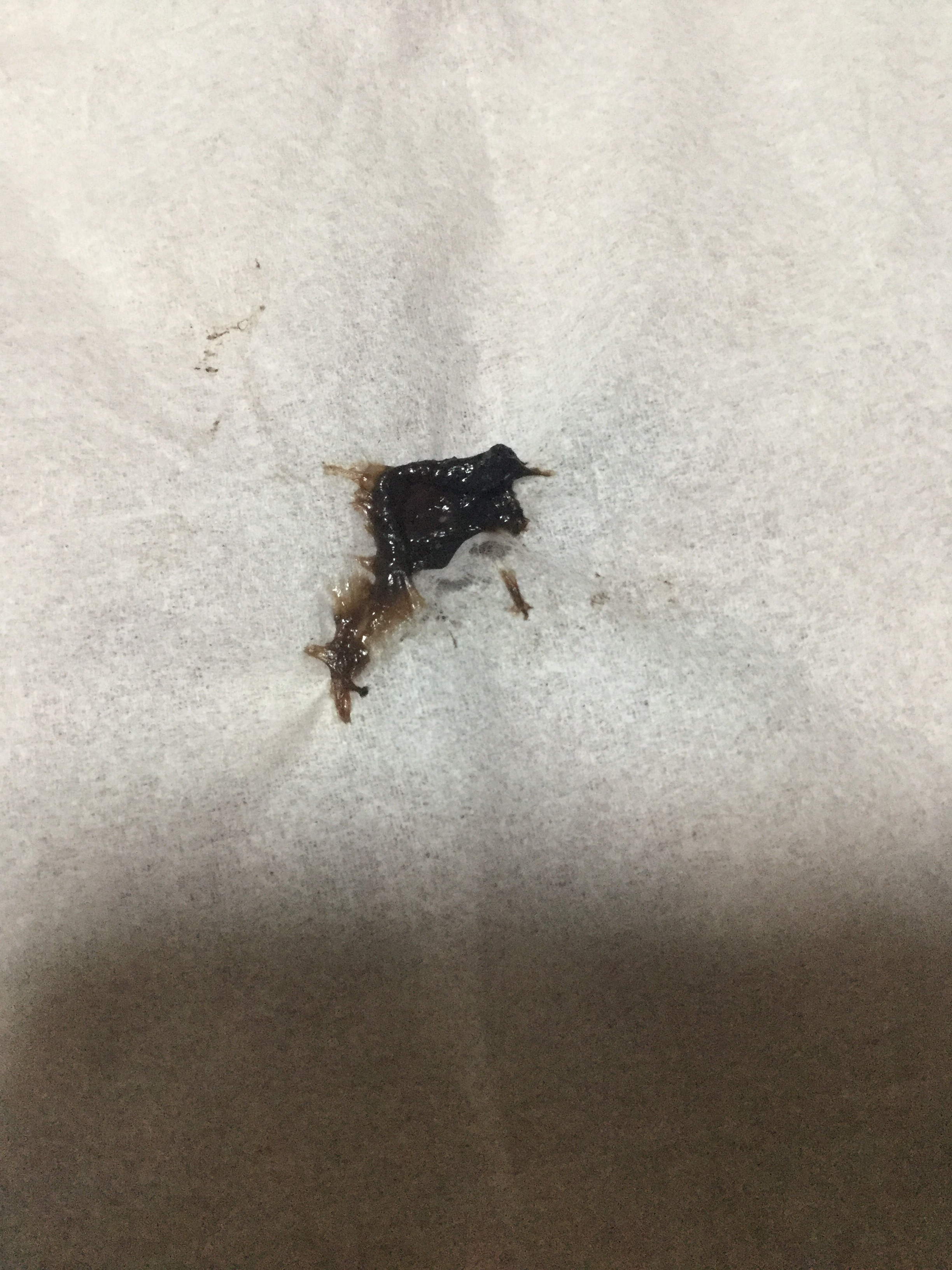 生理の黒い塊は病気のサイン？経血が変色する真相と受診の境界線