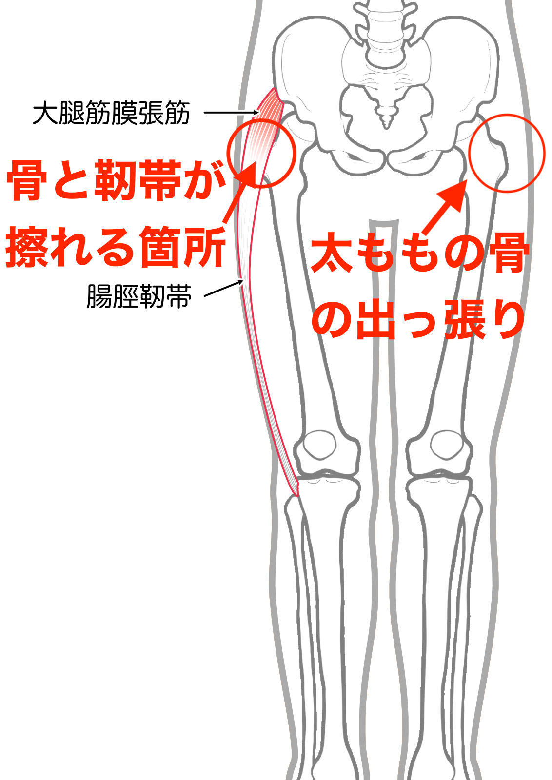 股関節がポキポキ鳴る弾発股の原因と治し方｜放置のリスクと最新改善法