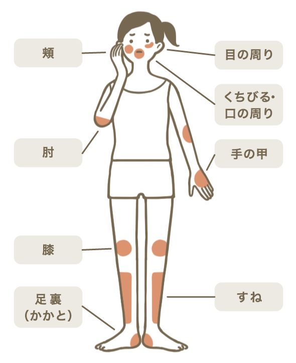 乾燥麹と生麹の違いを徹底比較！味や酵素・甘酒作りの最適解【2026】