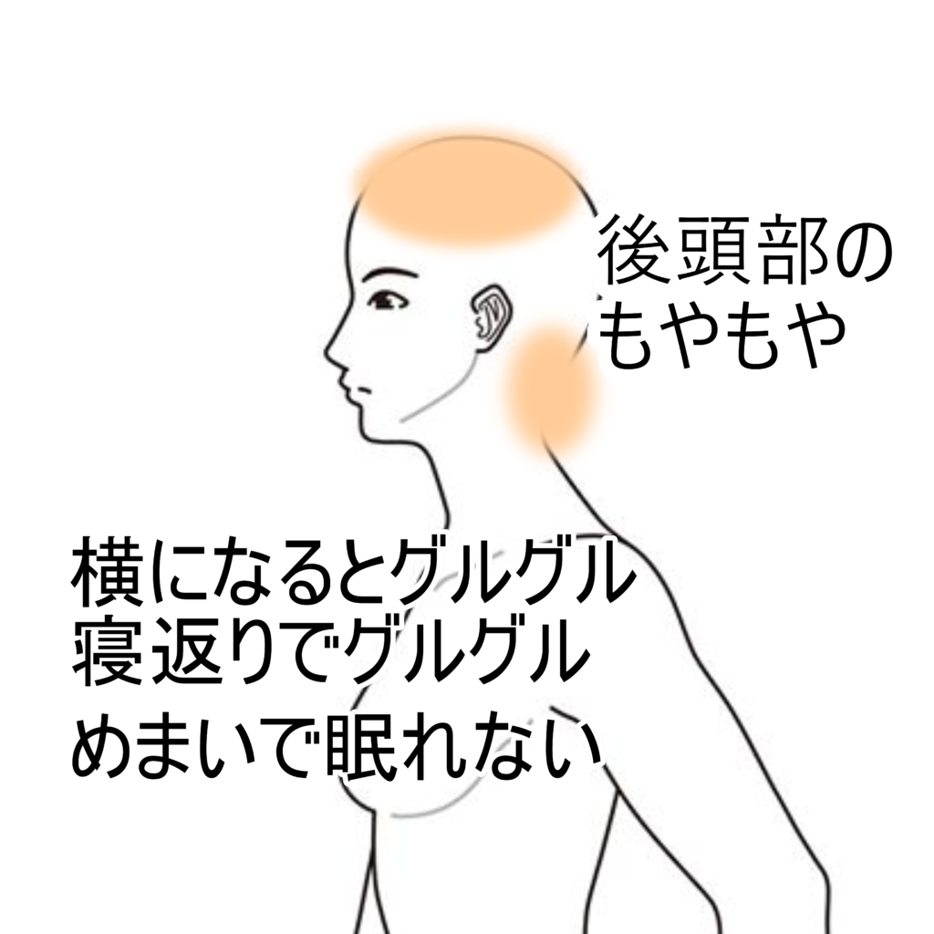 横になるとめまいがする本当の原因と危険な病気の見分け方