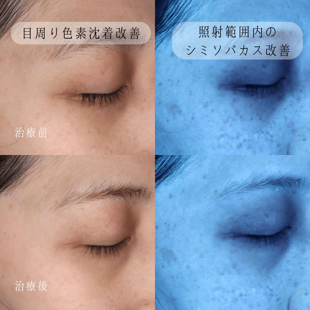 下がり天井の間接照明で後悔ゼロ！プロが明かす失敗回避の設計術
