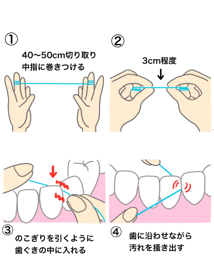 フロアフロス正しい使い方｜痛くない通し方と歯垢をごっそり落とすプロ技