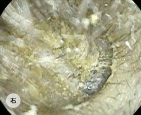 【Wiki風】 耳垢 湿っ て いる 話題のバズ動画・画像 #676