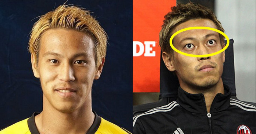 本田圭佑が語るバセドウ病克服への軌跡、過酷なリハビリ秘話と今