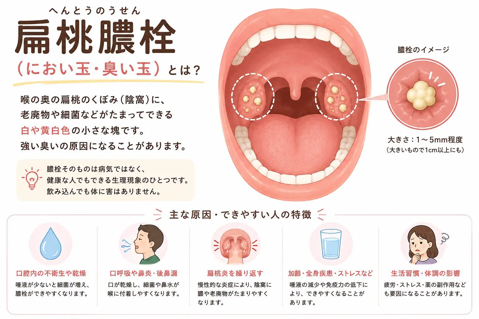 喉の奥の臭い玉はどう取る？自力除去の罠と安全な耳鼻科処置・最新予防法