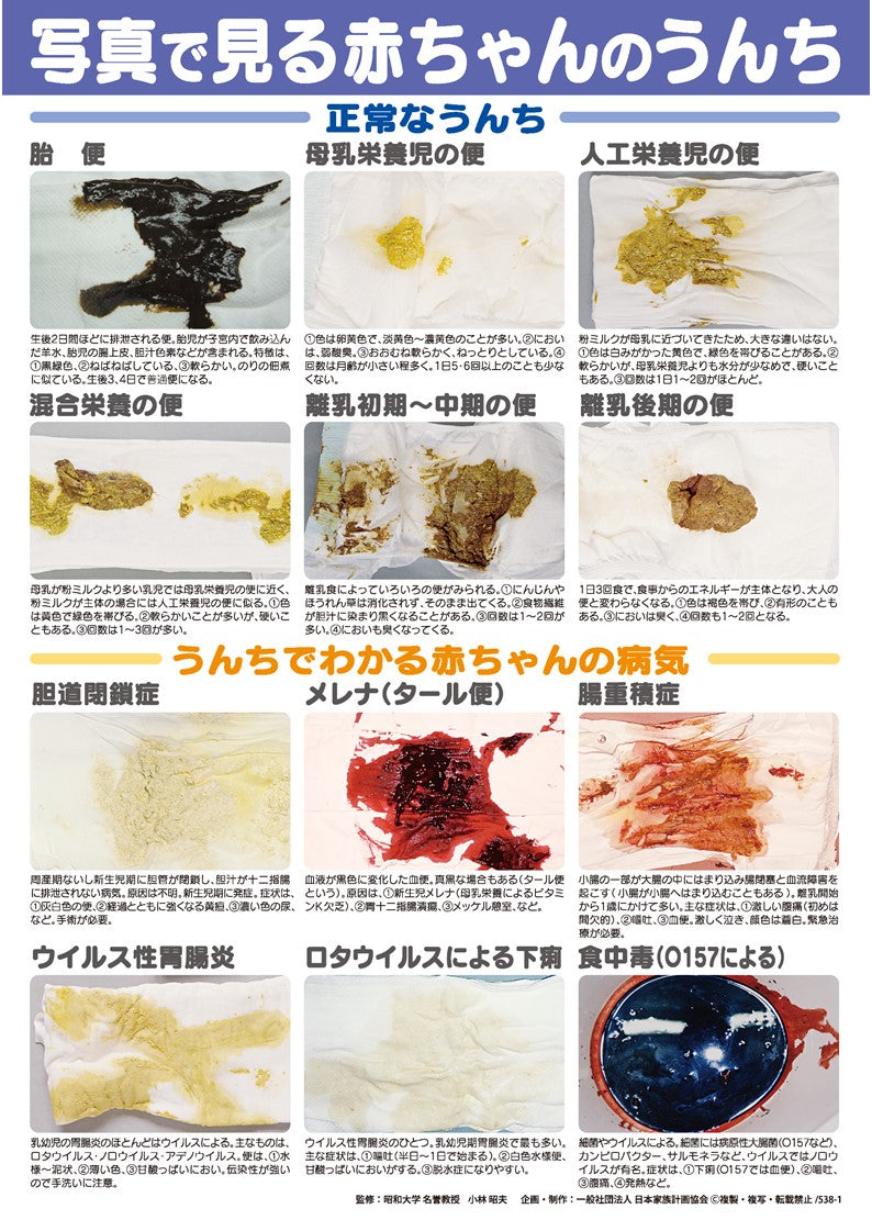 赤ちゃんの水様便は危険？下痢との見分け方と緊急受診サイン徹底検証
