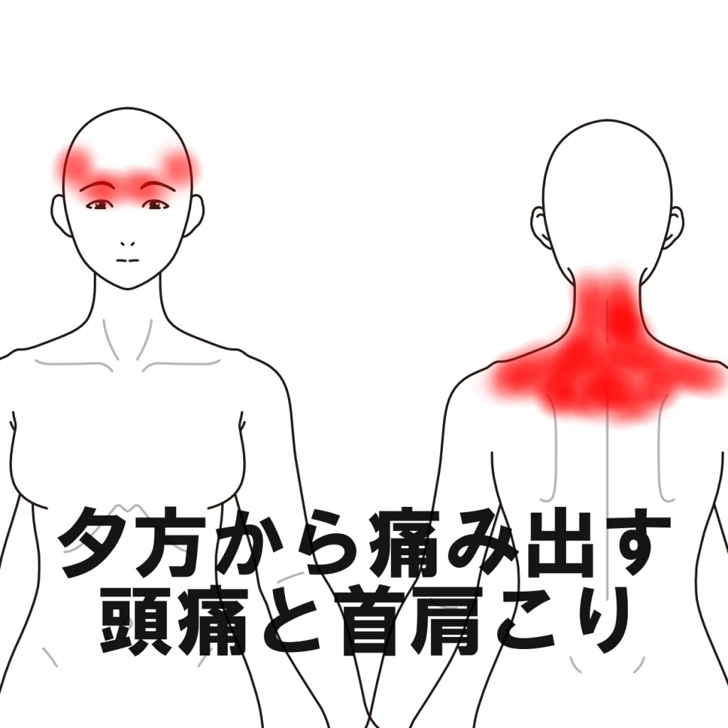 首が痛い頭痛はなぜ起きる？危険なサインと受診すべき診療科を徹底解説