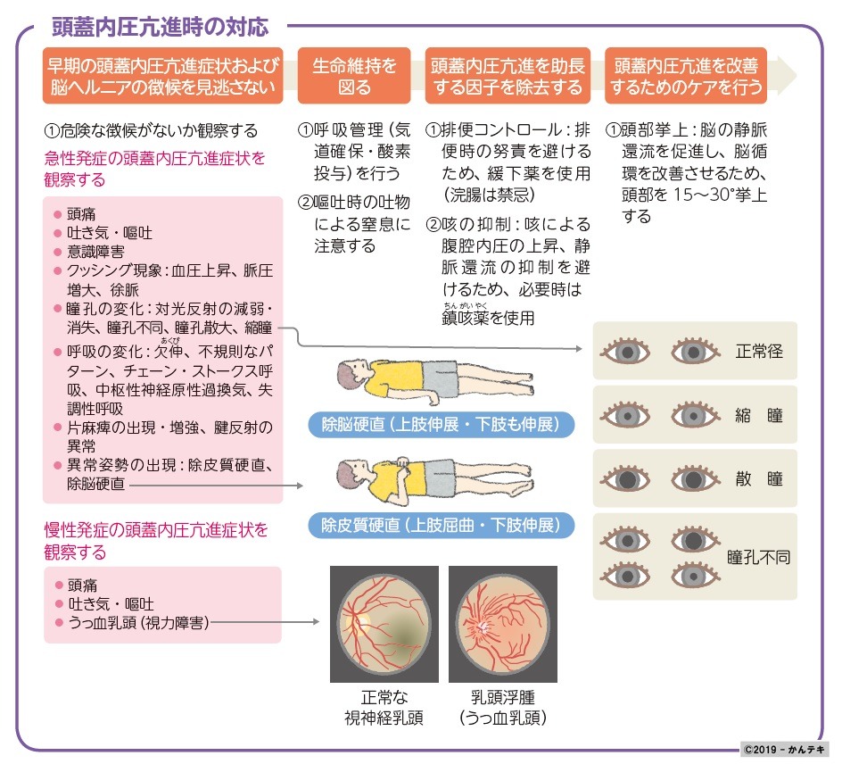 頭蓋内圧亢進の初期症状とは？3大徴候とクッシング現象の真実