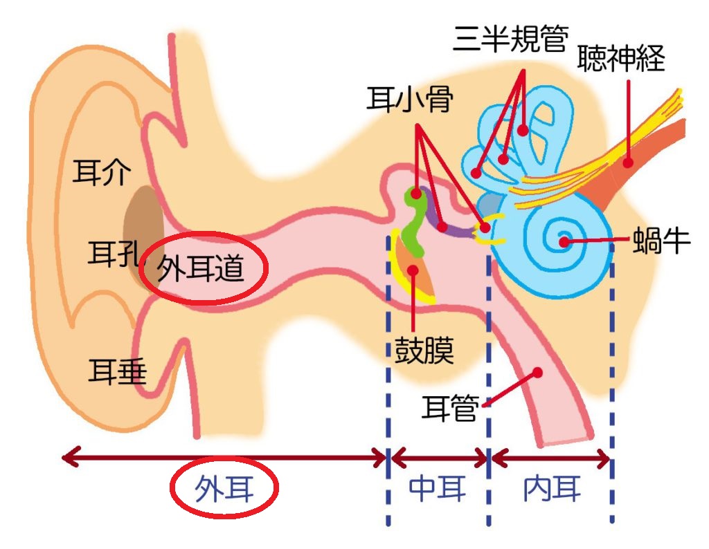 イヤホンで耳が痛い決定的な原因と対策！外耳道炎を防ぐ選び方2026