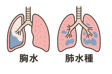 【Wiki風】 ベイプ 肺 に 水 が たまる 最新ニュース速報 2026 #673