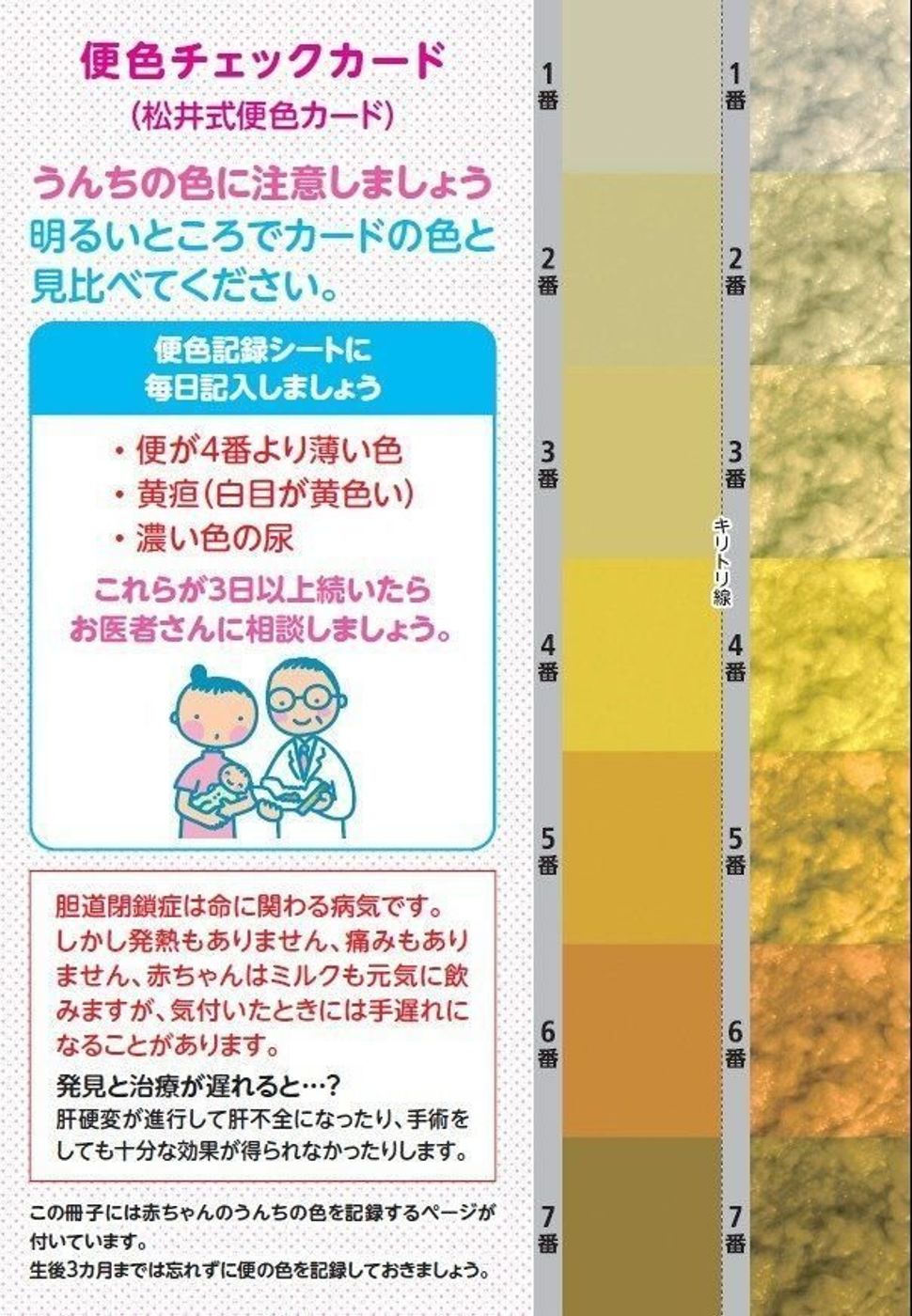 新生児のうんち色で危険を見分ける！緑や白の理由と受診目安【2026】