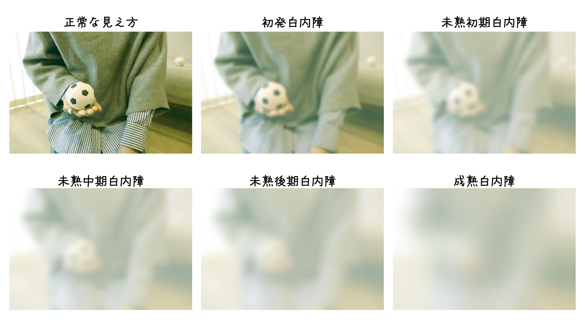 犬の白内障の見え方はどう変わる？初期症状から進行段階別の視界を徹底検証