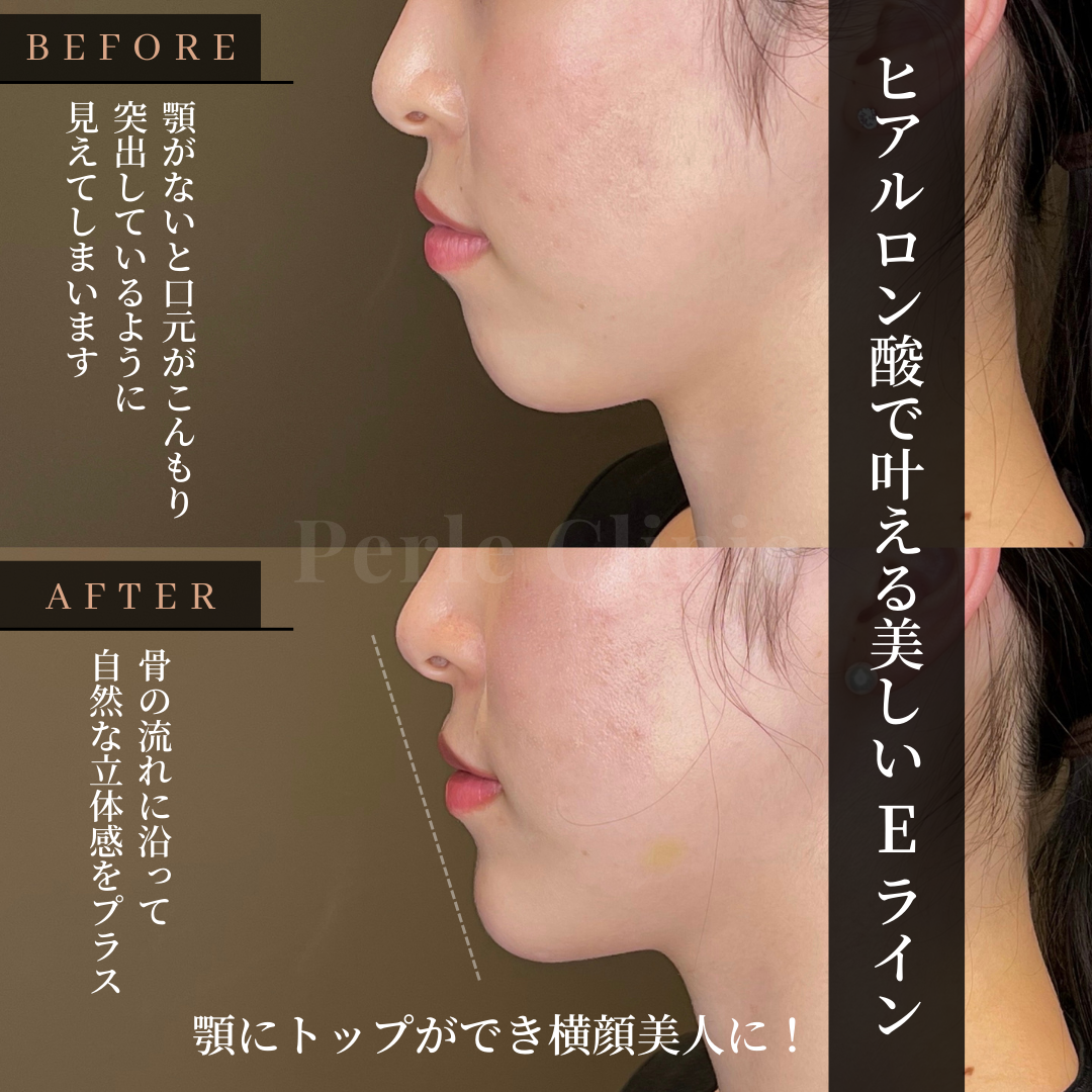 Eラインじゃない美人の共通点とは？黄金比を超えた横顔の魅力を解剖