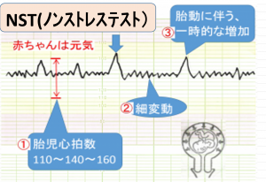 【衝撃】 ノン ストレス と は 最新ファイル＆画像まとめ #878
