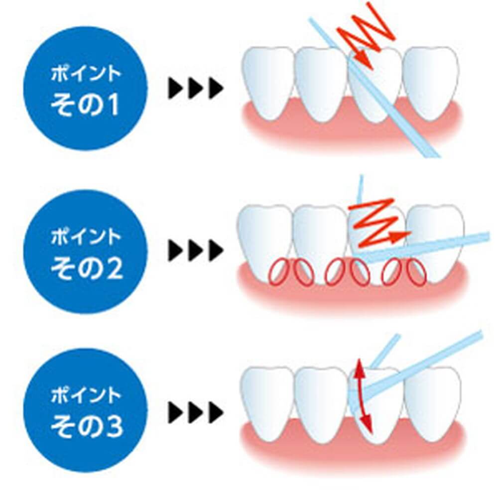 フロスはどこまで入れる？歯茎の痛みを防ぐ正しい深さと通し方