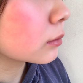 【必見】 顔 赤く なる 暖房 最新ファイル＆画像まとめ #724
