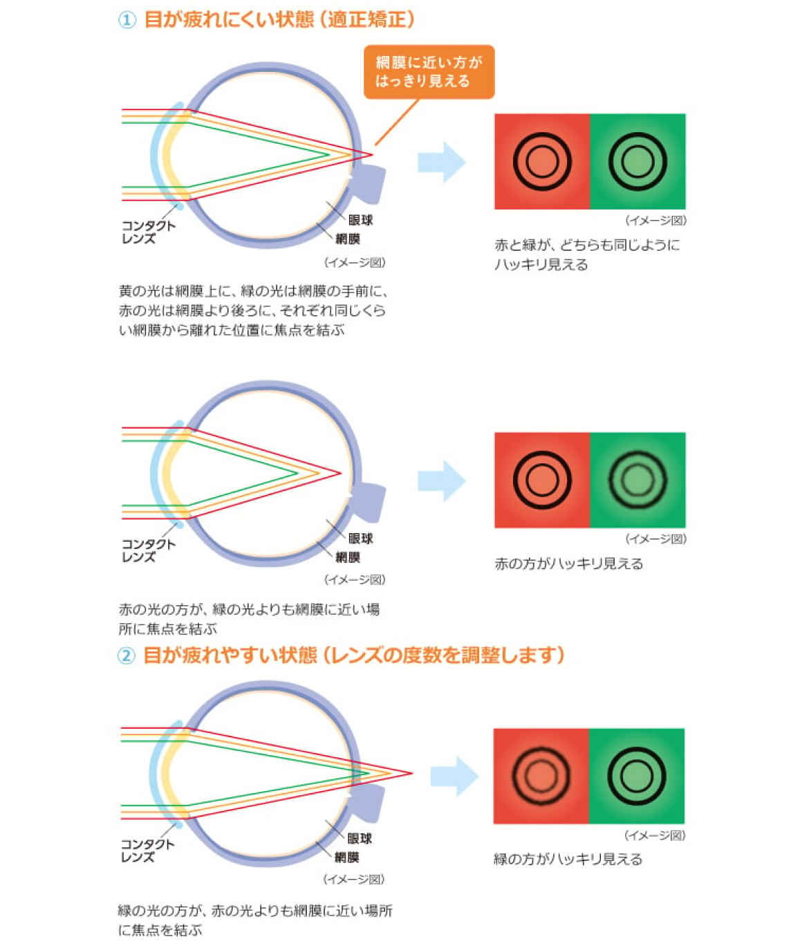 視力検査の赤緑テストとは？見え方の違いと過矯正の真相を徹底解説