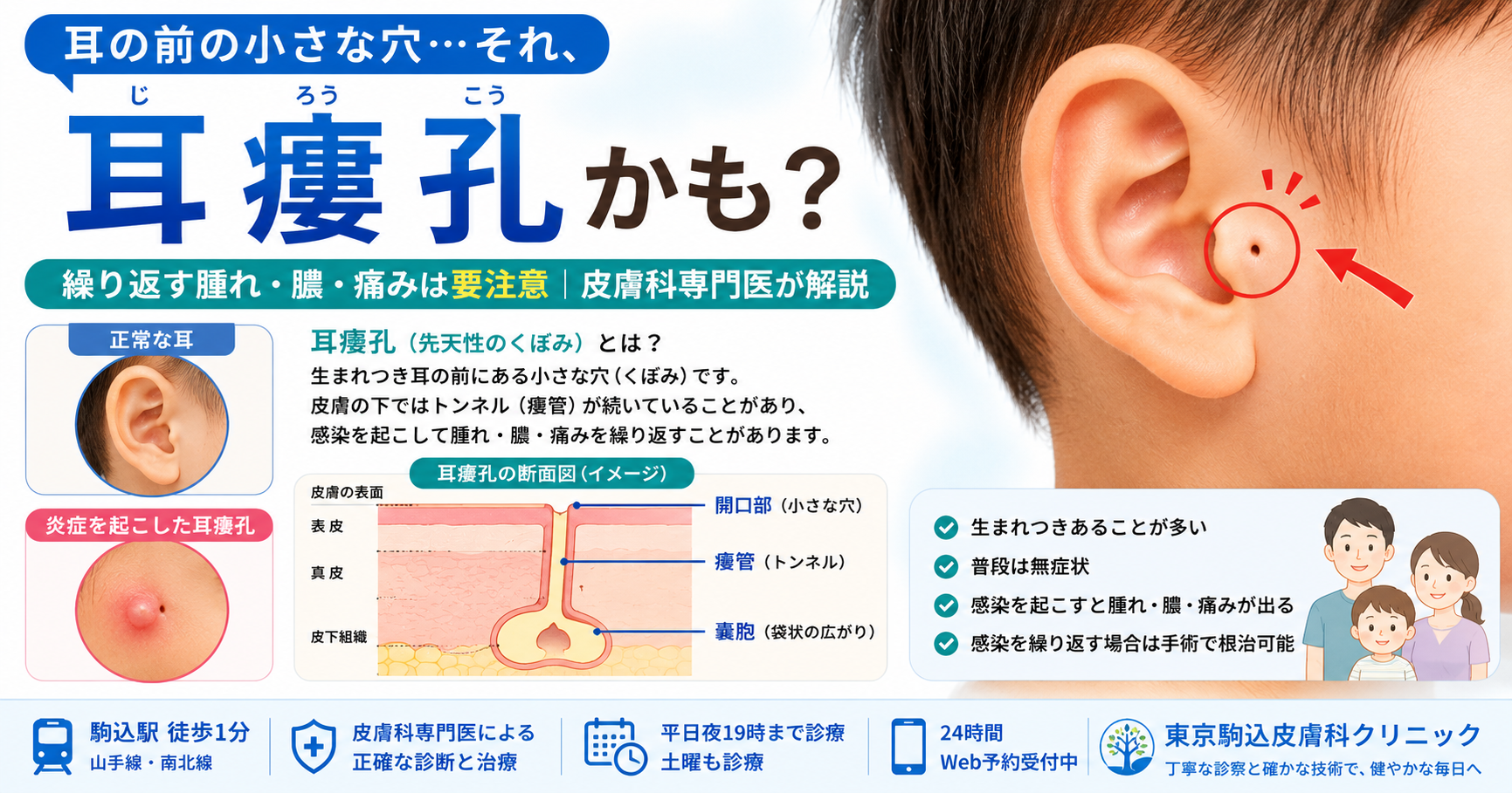 先天性耳瘻孔の臭いと膿はなぜ？放置の危険や手術費用・傷跡を解説