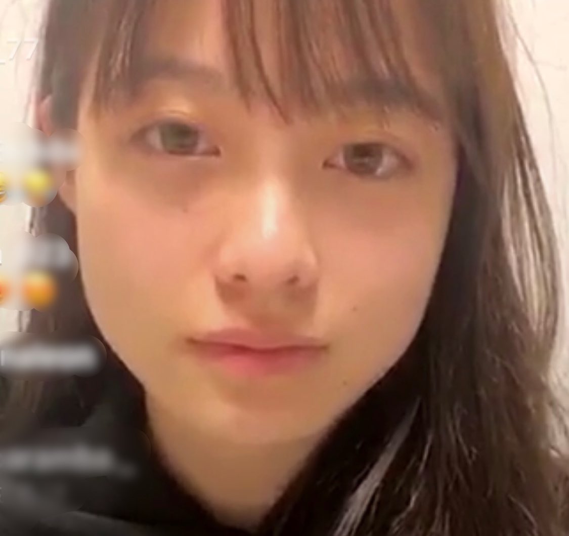 橋本環奈のすっぴん画像に衝撃！肌荒れの真相と2026年現在の素顔