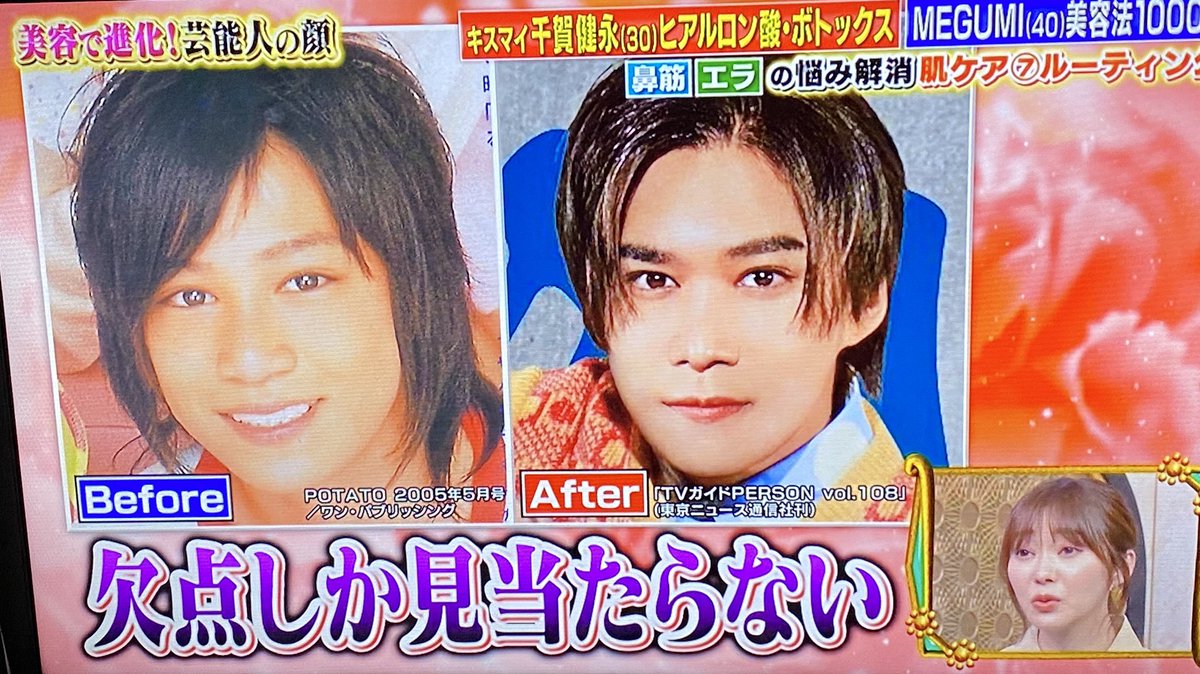 キスマイ整形前の真相！Jr時代からの変化と公言の裏側を徹底検証