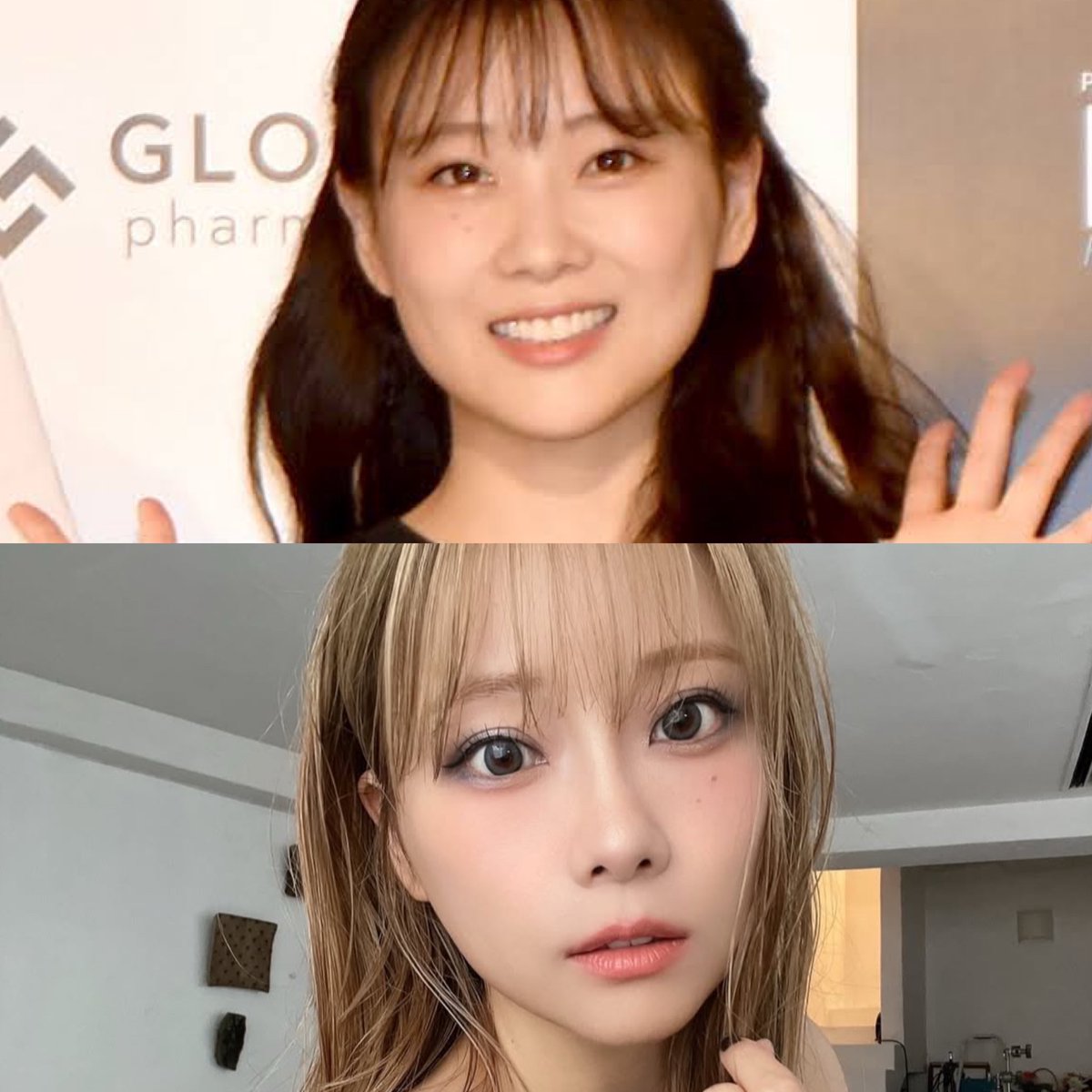 重盛さと美の整形疑惑は本当？昔と現在の顔変化と美しさの真相を解明