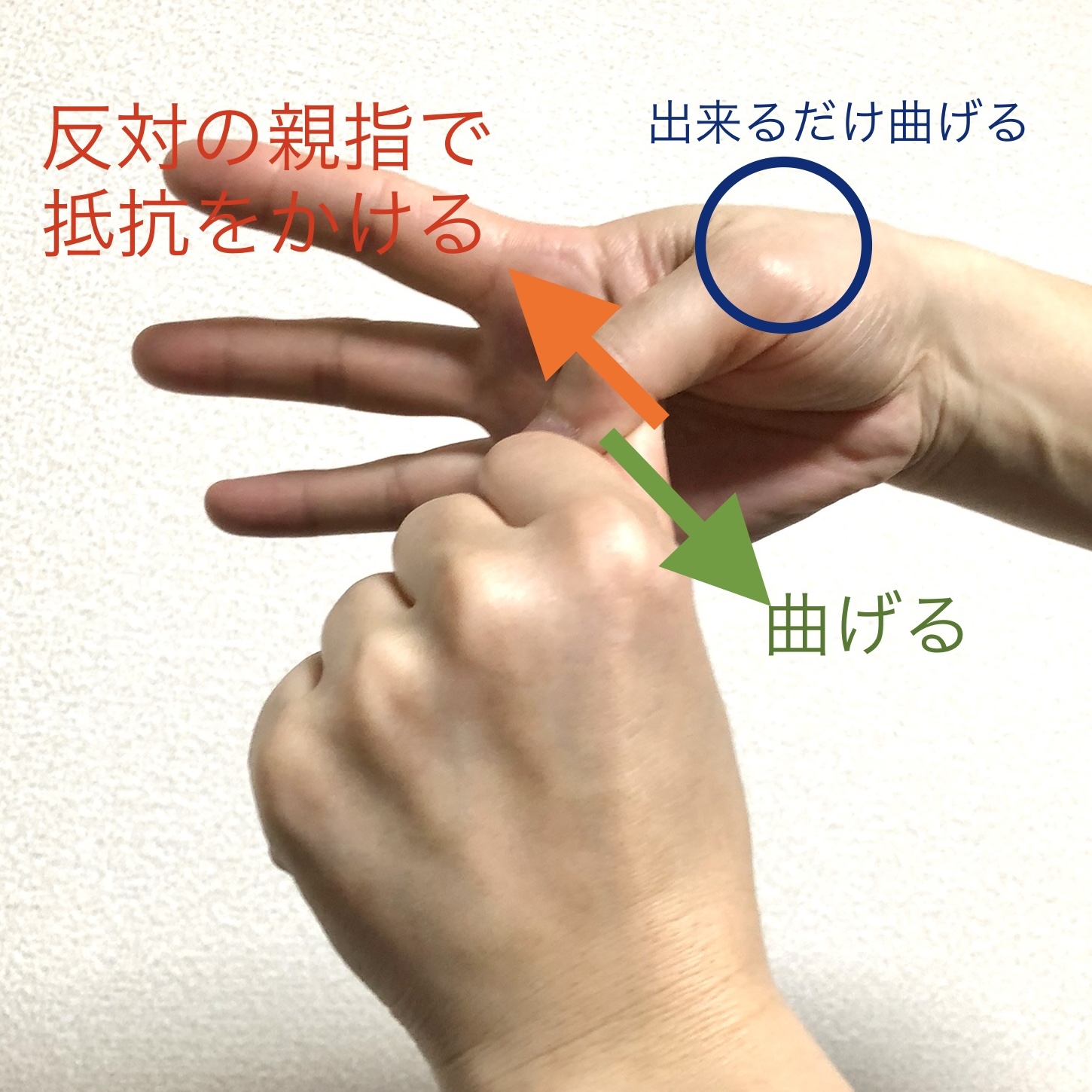 親指の第一関節が痛い原因とは？押すと痛む腫れ・へバーデン結節の真相