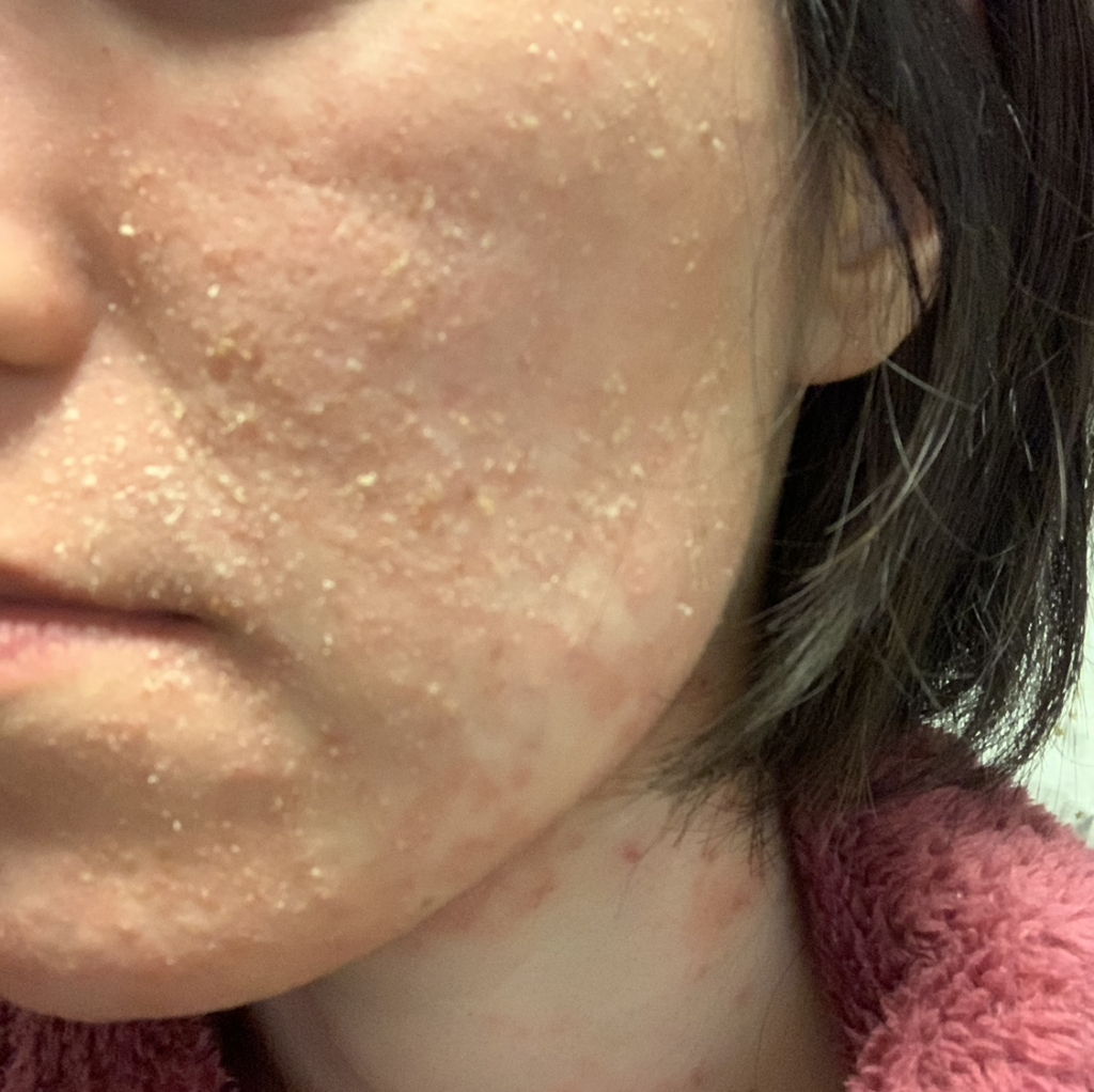 肌断食とは？効果と失敗する決定的な理由・正しいやり方を徹底解説