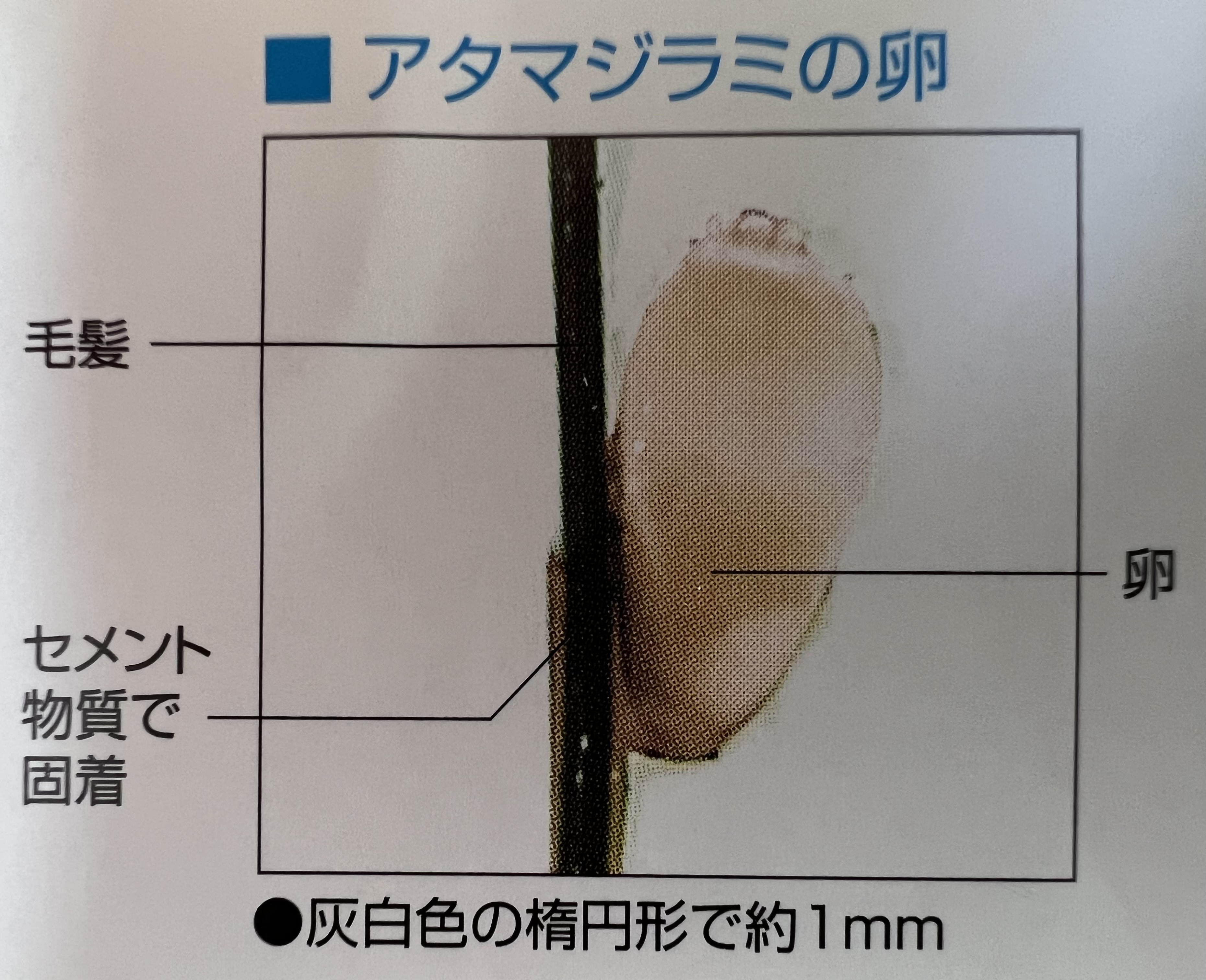 頭皮の白い粒はシラミの卵？フケとの見分け方と2026年最新の取り方