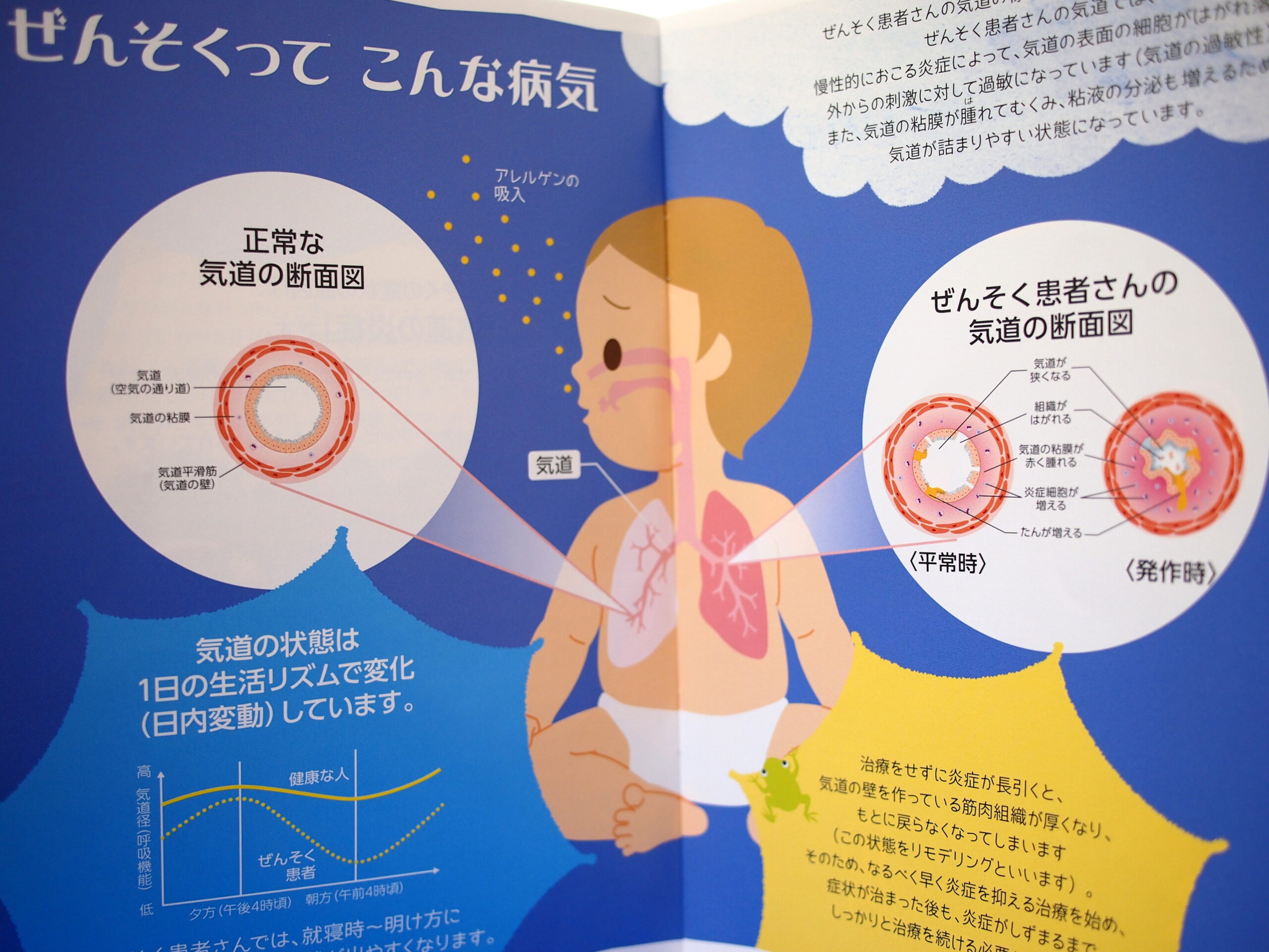 咳が酷くて寝れない夜の止め方｜横になると悪化する原因と最新対策